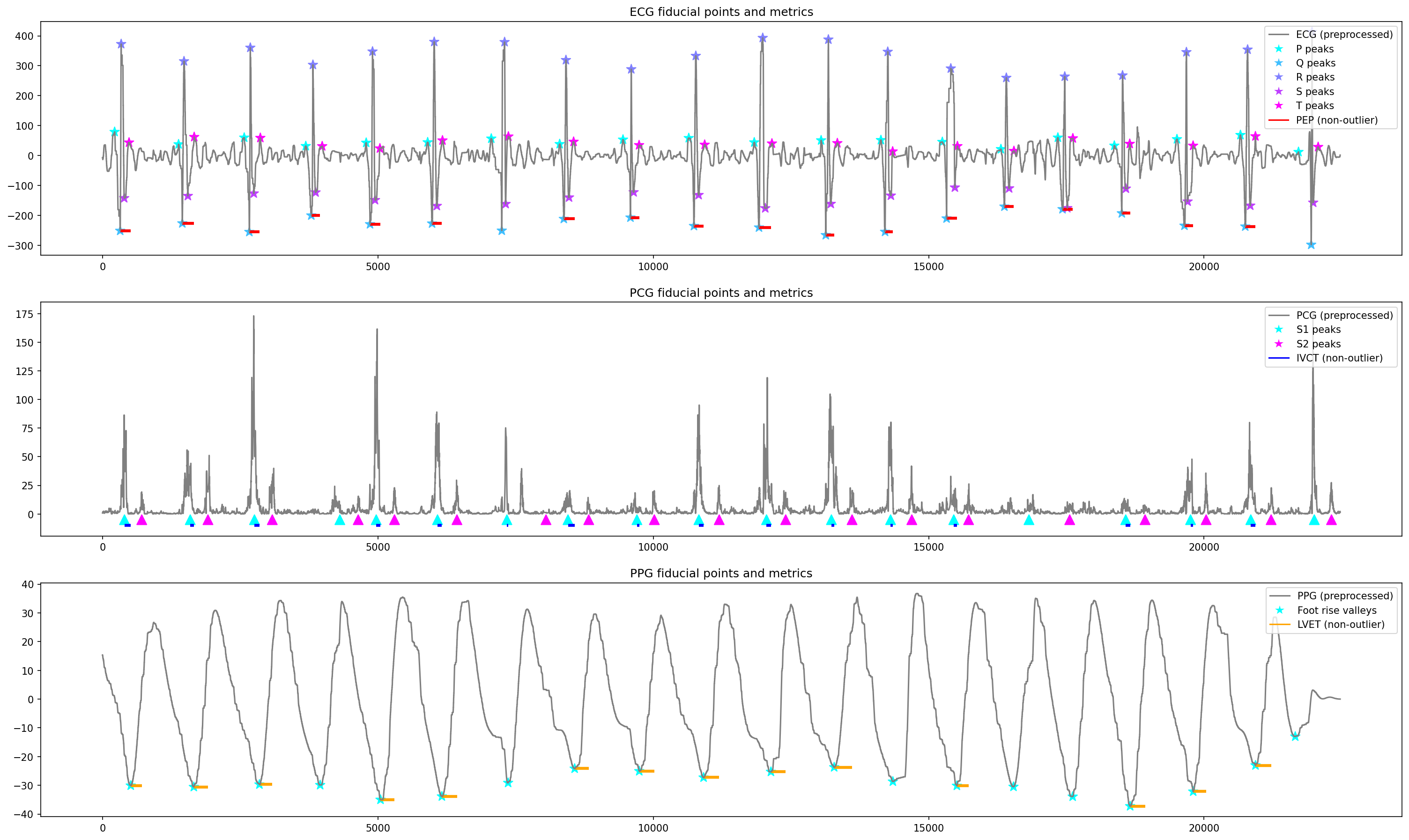 AI-based calculating vital cardiovascular metrics