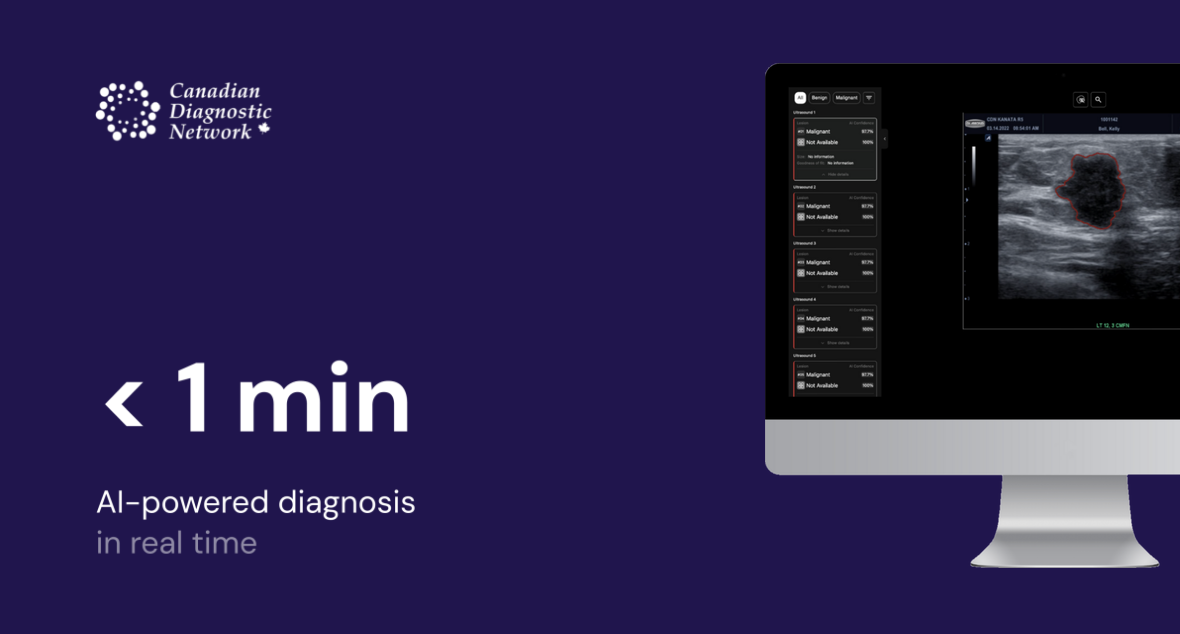 AI Breast Cancer Detection Platform