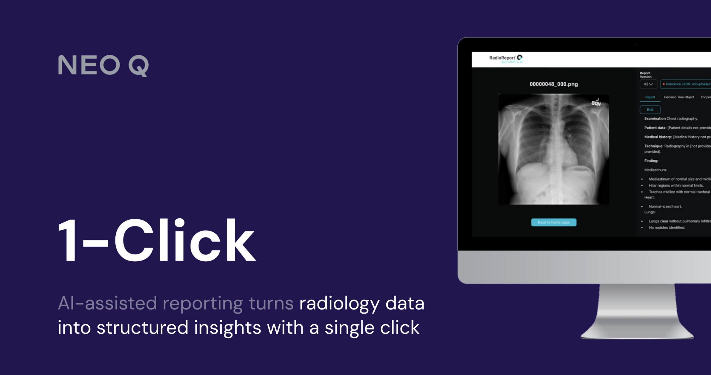 One-Click AI Platform for Medical Image-to-Report Conversion